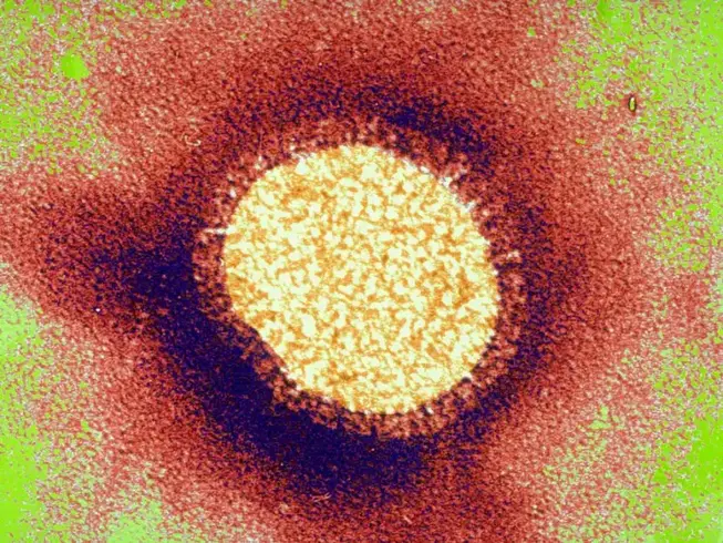 Influenza virus Sanofi Pasteur grippe photo
